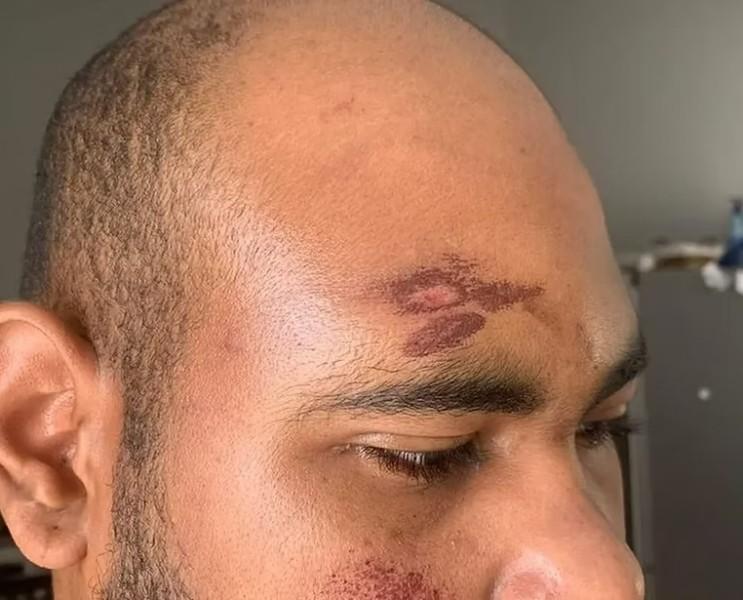 Procès à Carcassonne pour l’agression raciste d’un Mahorais et d’un Guadeloupéen
