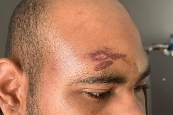 Procès à Carcassonne pour l’agression raciste d’un Mahorais et d’un Guadeloupéen