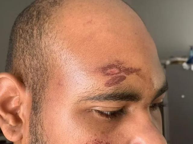 Procès à Carcassonne pour l’agression raciste d’un Mahorais et d’un Guadeloupéen